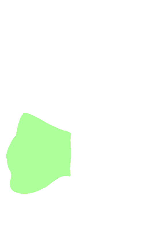 Lateral Condyle