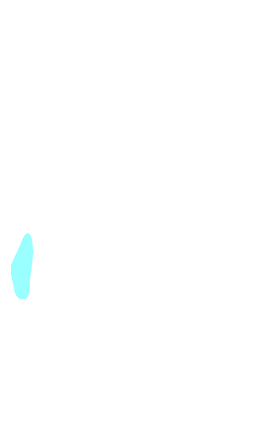 Lateral Epicondyle