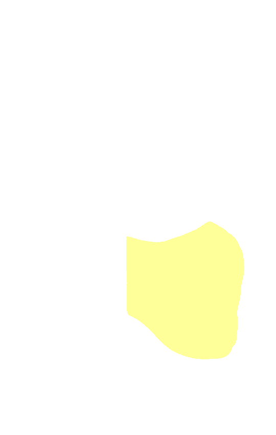 Medial Condyle