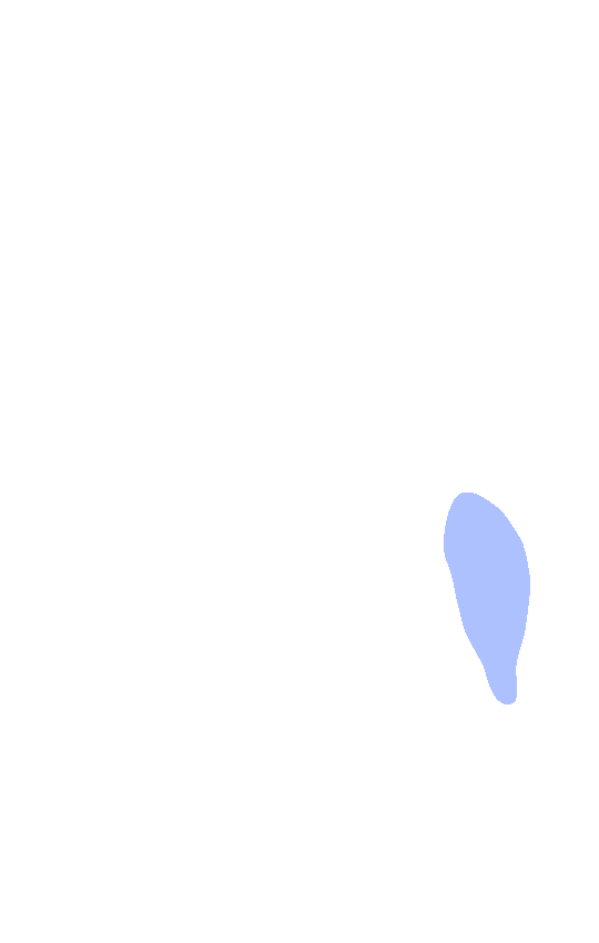 Medial Epicondyle