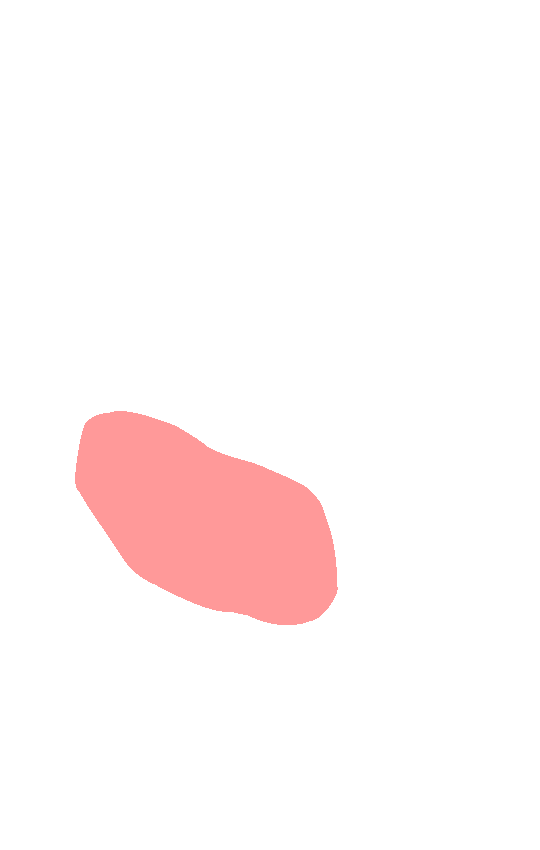 Patellar Surface