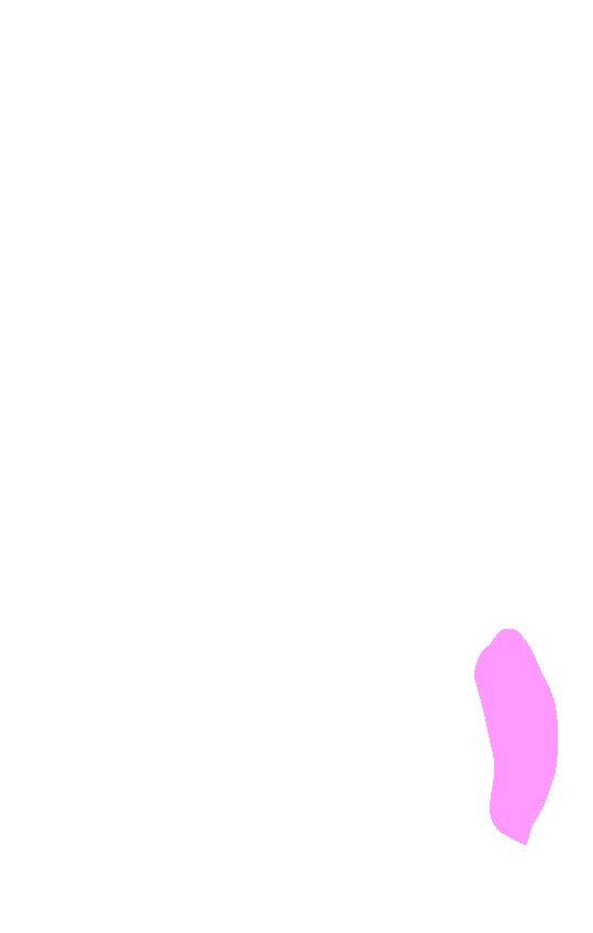 Medial Epicondyle