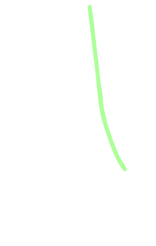 Medial Supracondylar Line
