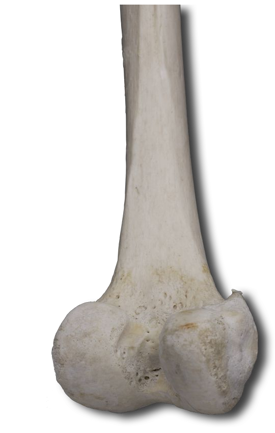 Distal Posterior