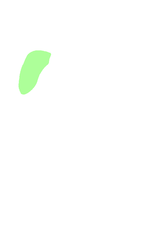 Greater Trochanter