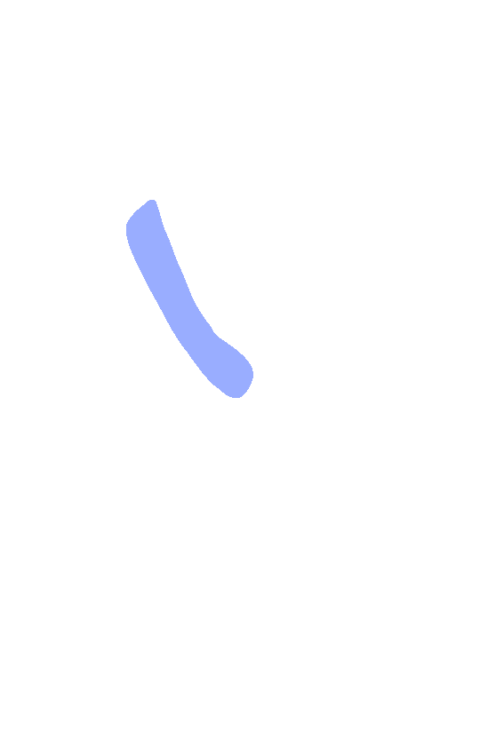 Intertrochanteric Line