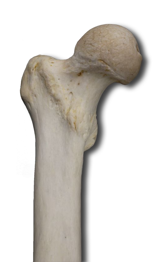 Proximal Anterior