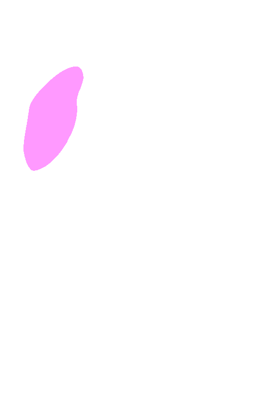 Greater Trochanter