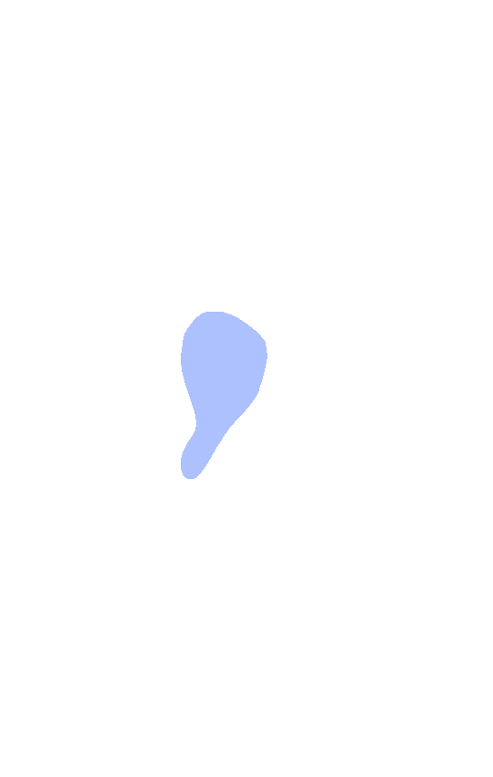 Lesser Trochanter