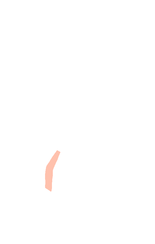 Pectineal Line