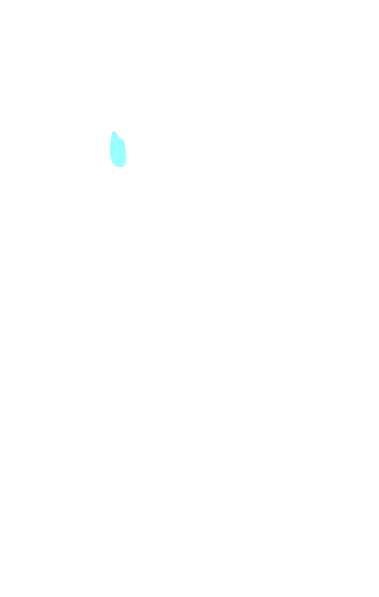 Trochanteric Fossa