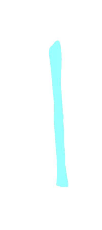 Linea Aspera
