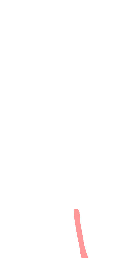 Medial Supracondylar Line