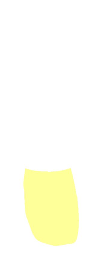 Lateral Malleolus