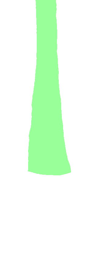 Lateral Surface