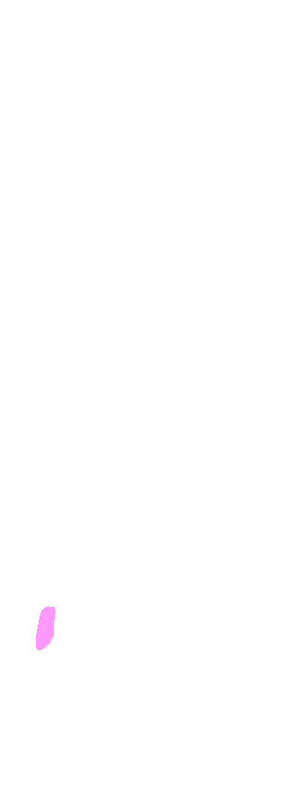 Groove for Peroneus Brevis Tendon