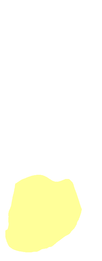 Lateral Malleolus