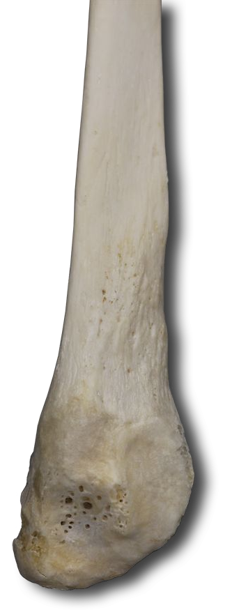 Distal Posterior-Medial