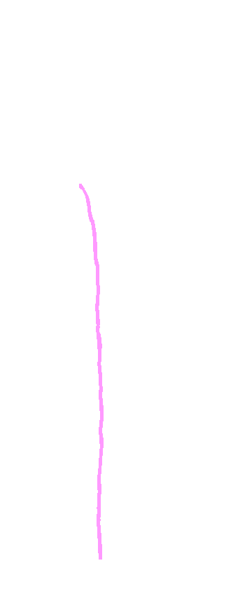 Interosseous Border