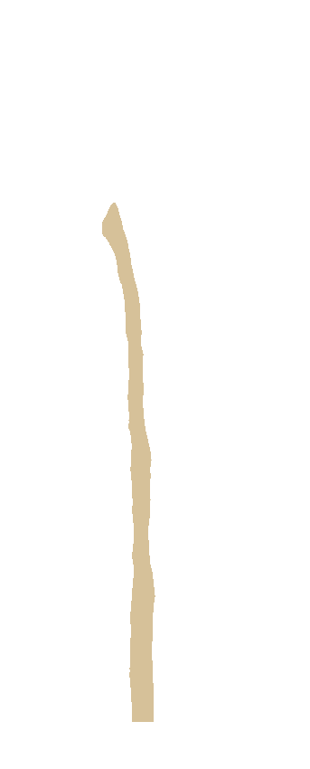 Medial Surface