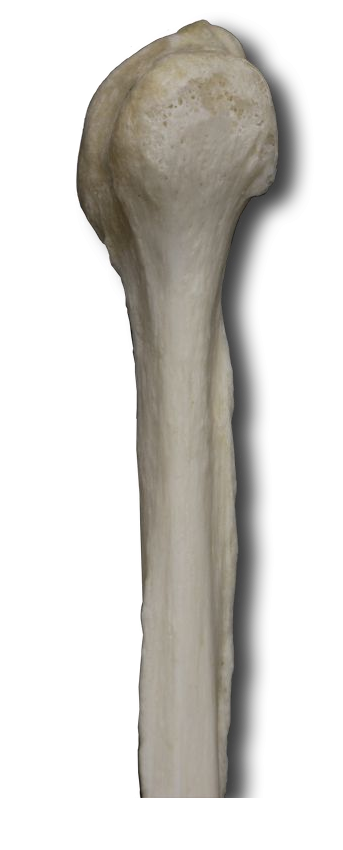 Proximal Anterior-Lateral