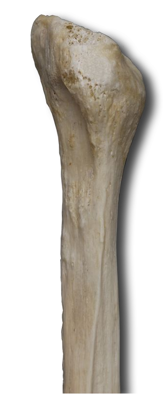Proximal Posterior-Medial
