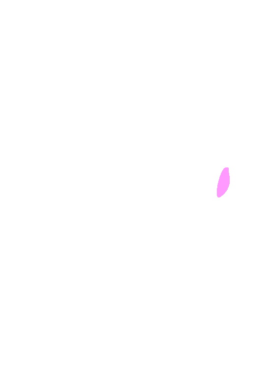 Anterior Inferior Iliac Spine