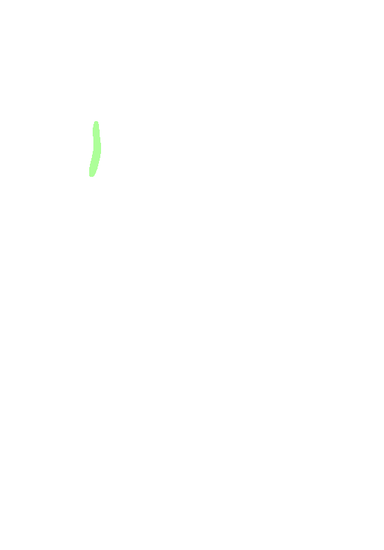 Posterior Gluteal Line