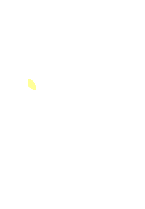 Posterior Inferior Iliac Spine