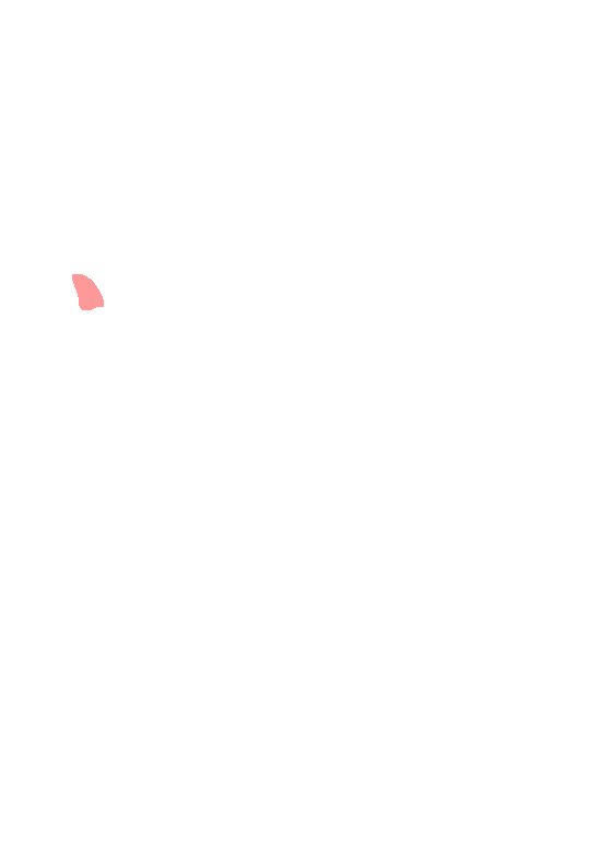 Posterior Superior Iliac Spine