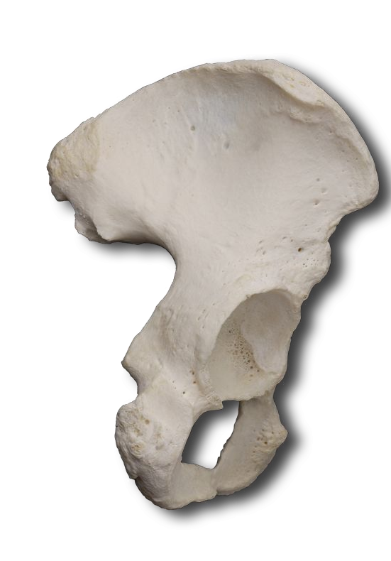 Posterior-Lateral Ilium