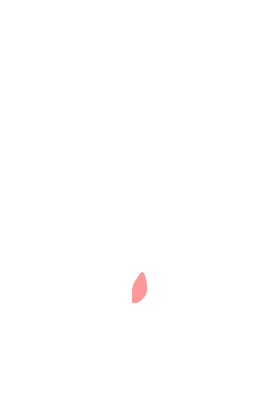 Ischial Spine