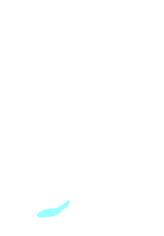 Ischial Tuberosity