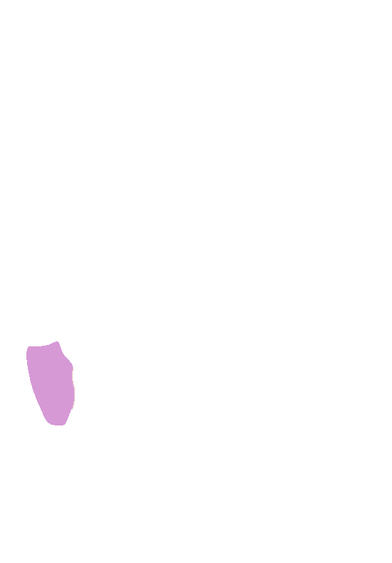 Symphyseal Surface