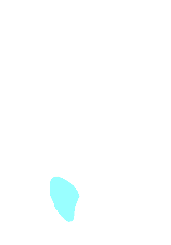 Ischial Tuberosity