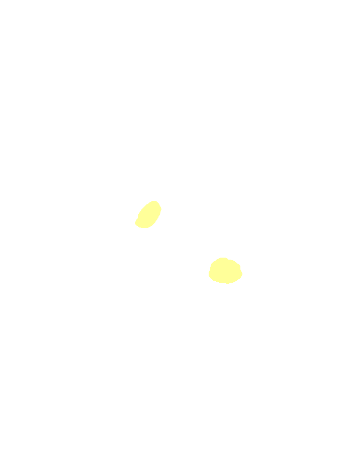Calcaneofibular Ligament