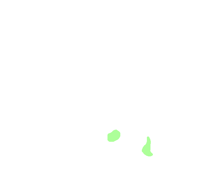Plantar Calcaneonavicular (Spring) Ligament
