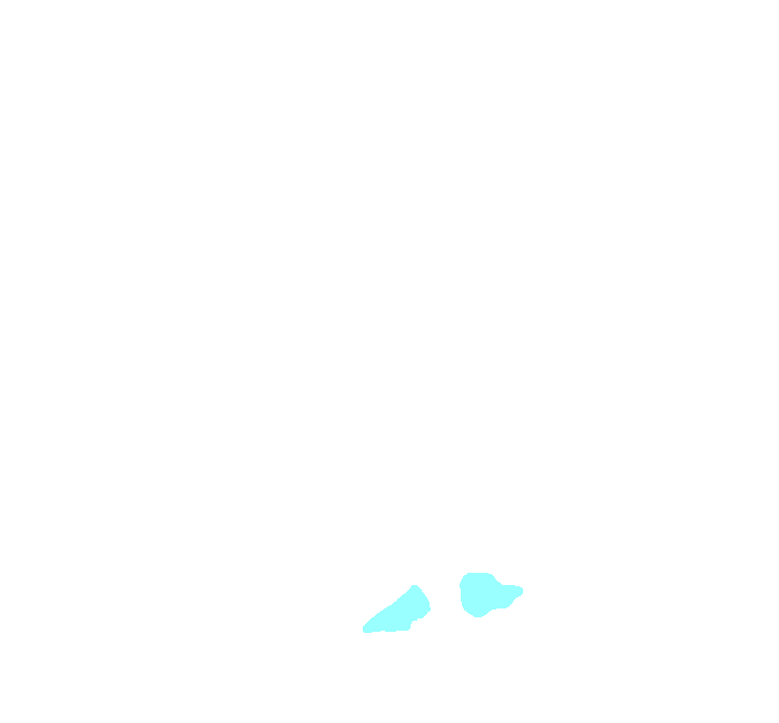 Short Plantar Ligament