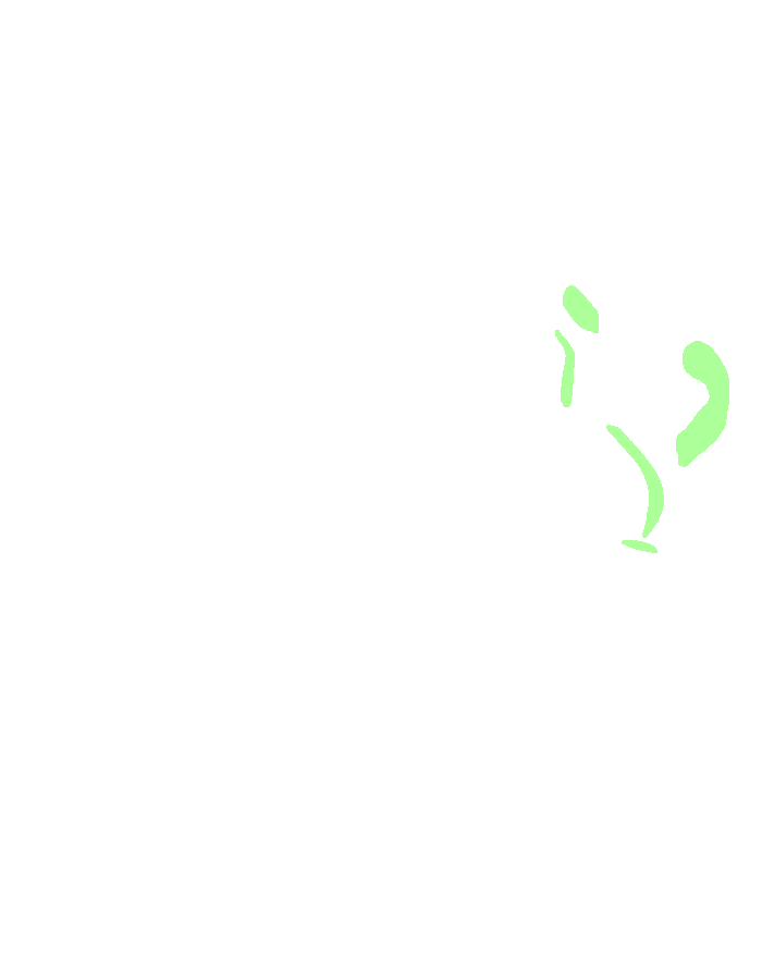 Medial (Deltoid) Collateral Ligament