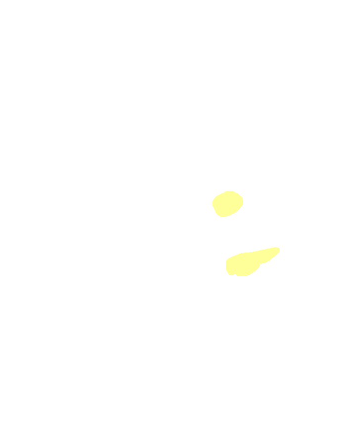 Plantar Calcaneonavicular (Spring) Ligament