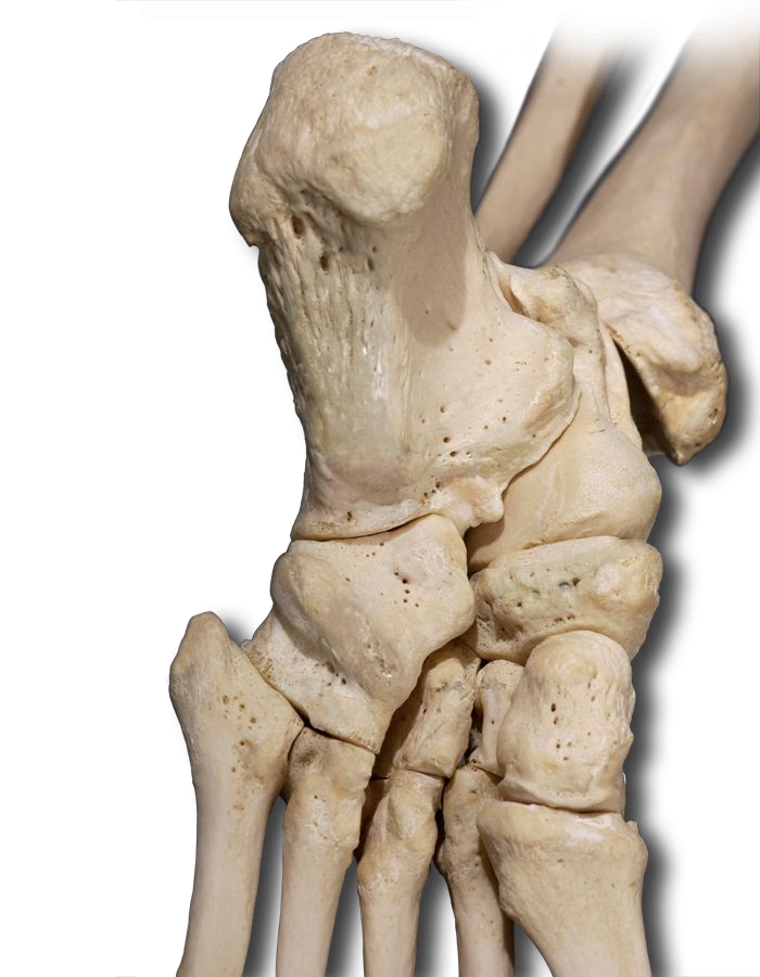 Plantar Foot