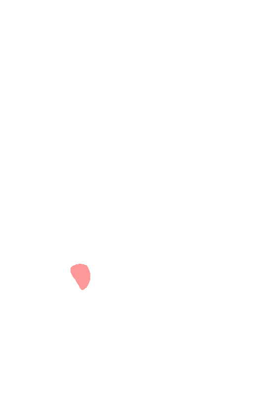 Posterior Cruciate Ligament