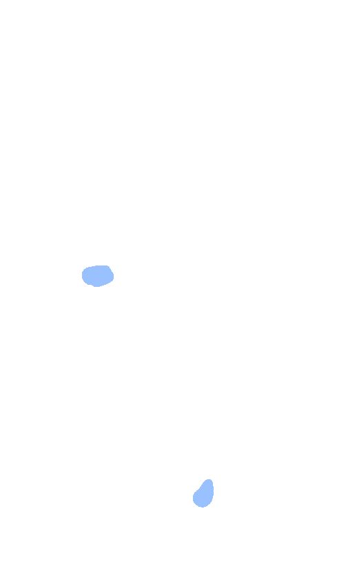 Fibular (Lateral) Collateral Ligament