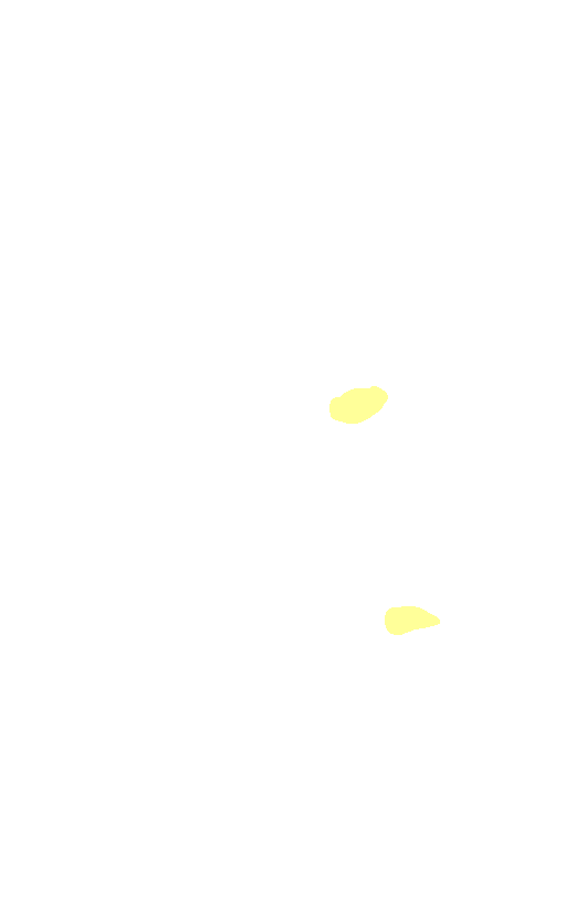 Posterior Cruciate Ligament