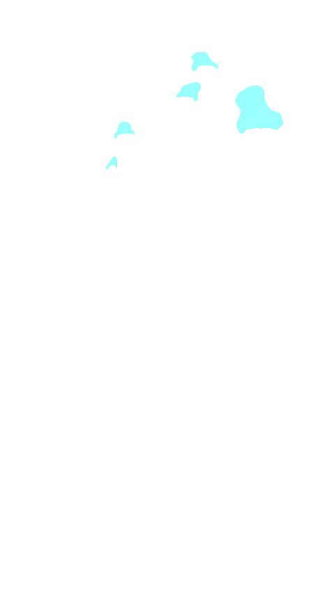 Distal Phalanges