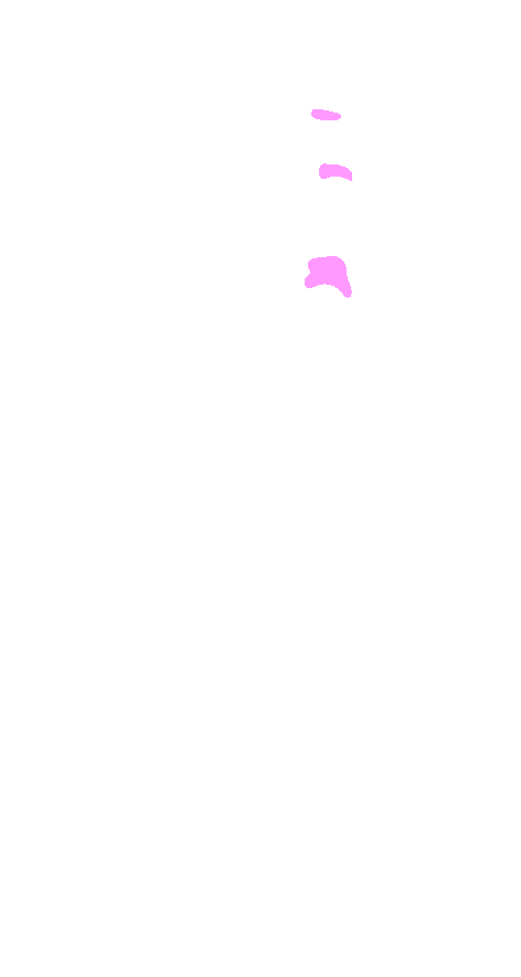 Head