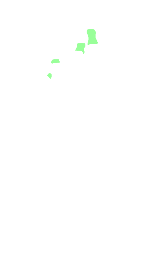 Middle Phalanges