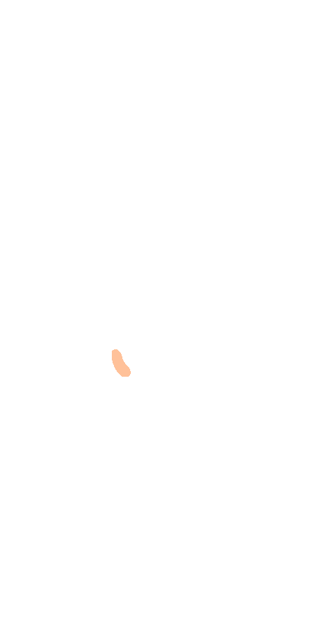 Tuberosity (5th)