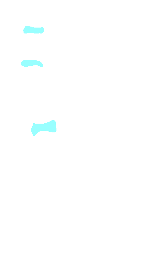 Base
