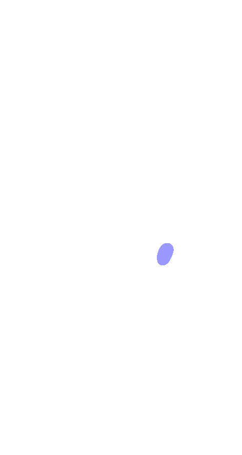 Tuberosity (5th)